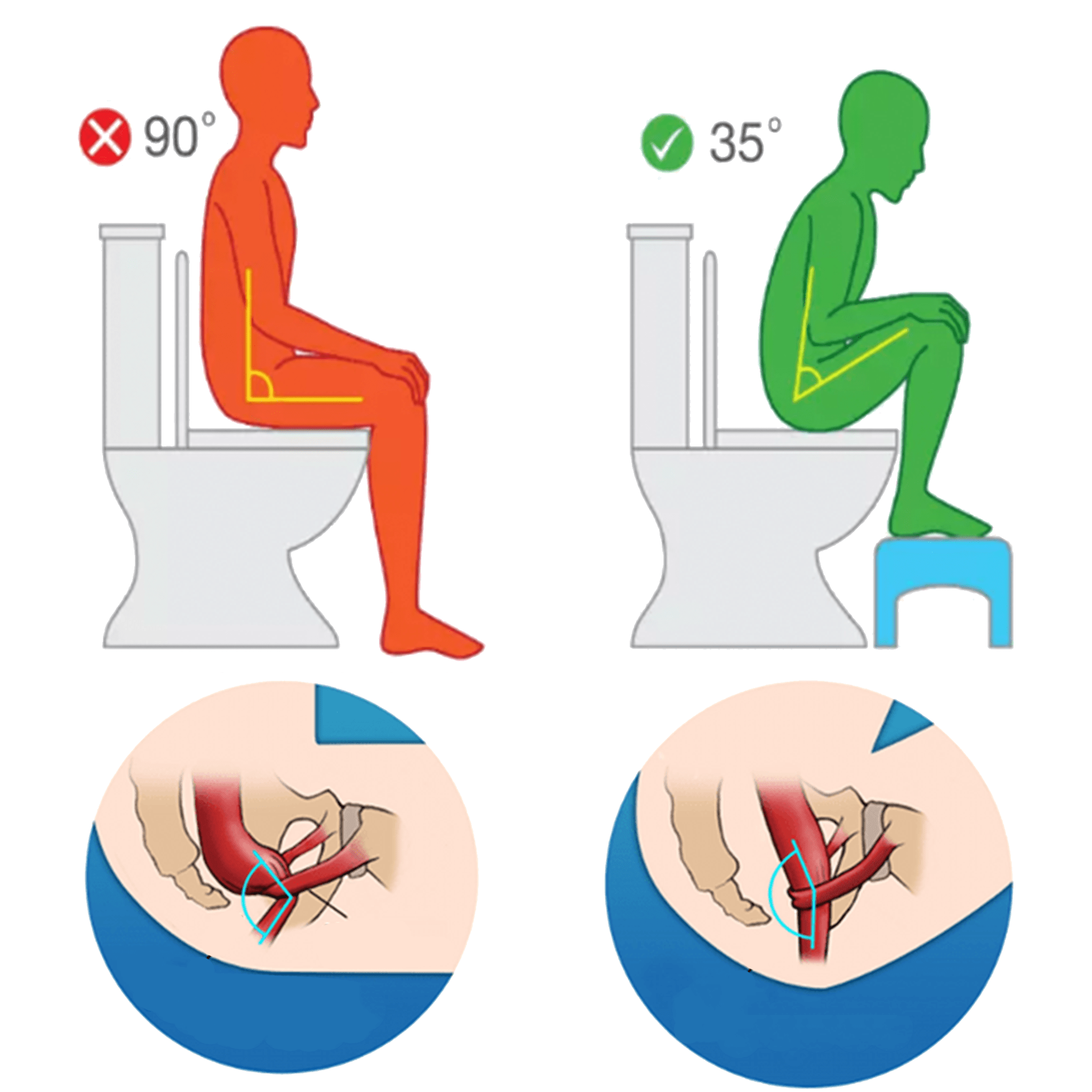 POTTY PLUS ™ - Tabouret Physiologique Ergonomique de Toilettes – 🐵 Alouate